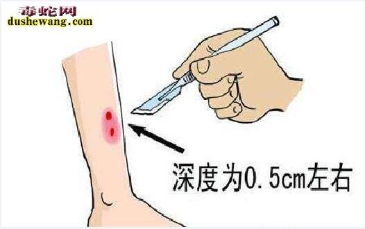 澳门49图库和女子遭毒蛇咬伤身亡与女子遭毒蛇咬伤身亡视频